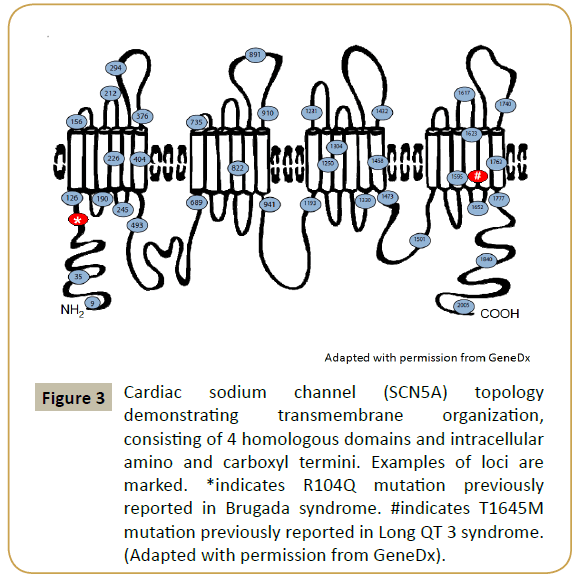 pediatric-cardiology-Cardiac-sodium-channel