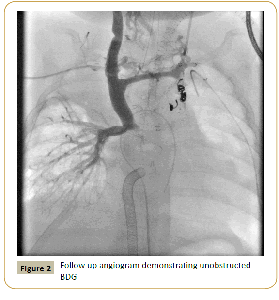pediatric-cardiology-angiogram-demonstrating-unobstructed