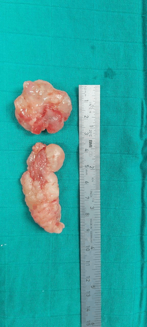 pediatric-cardiology-showing-macroscopic